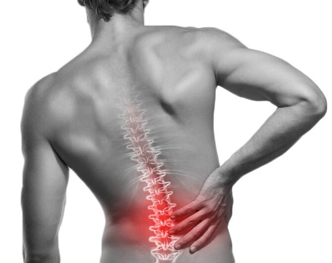 Podes eliminar facilmente a dor na columna vertebral debido á osteocondrose usando unha esterilla de acupresión Motion Mat